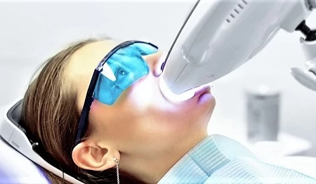 Відбілювання зубів ультрафіолетом