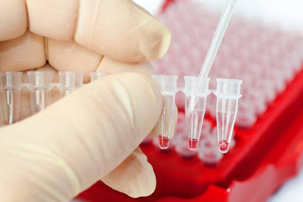 Украина закупила быстрые тесты по диагностированию вирусного гепатита С