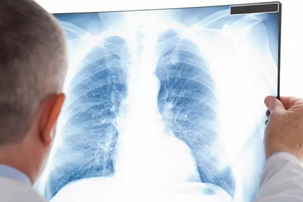 Ученые разрабатывают новую методику для выявления туберкулеза