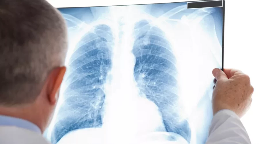 Ученые разрабатывают новую методику для выявления туберкулеза